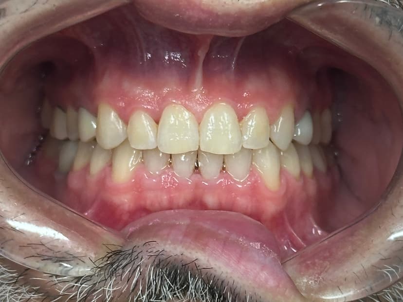 Patient 3 after